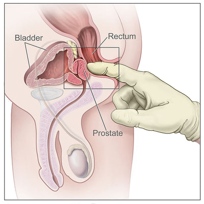 Beginner's Guide to Prostate Stimulation